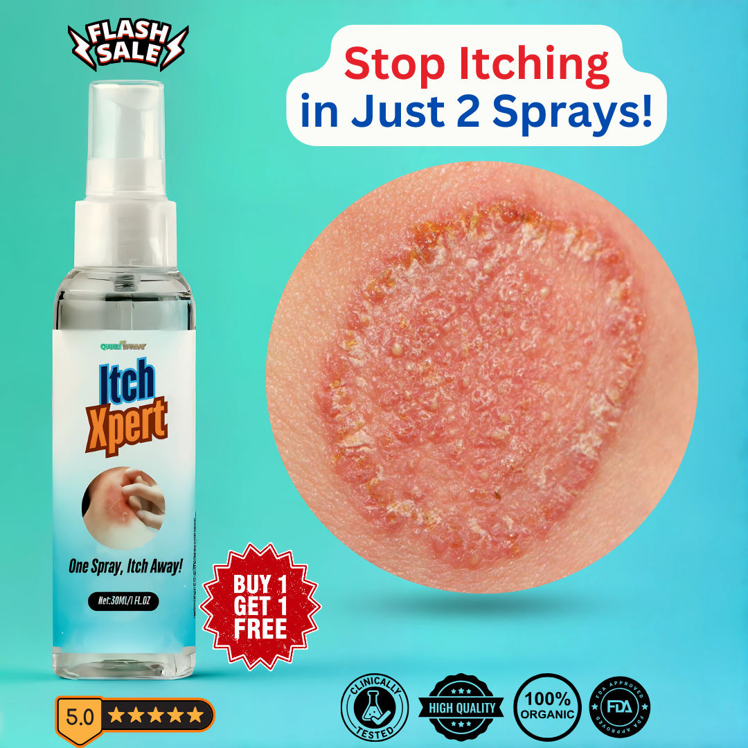 ItchXpert Anti Fungal Spray (30ml)