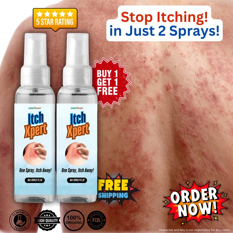 ItchXpert Anti Fungal Spray (30ml)