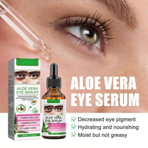 Aloe Vera Eye Serum (30ml) – ✨ Fades Eye Dark Circles, Wrinkles & Fine Line