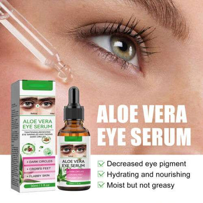Aloe Vera Eye Serum (30ml) – ✨ Fades Eye Dark Circles, Wrinkles & Fine Line