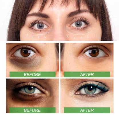 Aloe Vera Eye Serum (30ml) – ✨ Fades Eye Dark Circles, Wrinkles & Fine Line