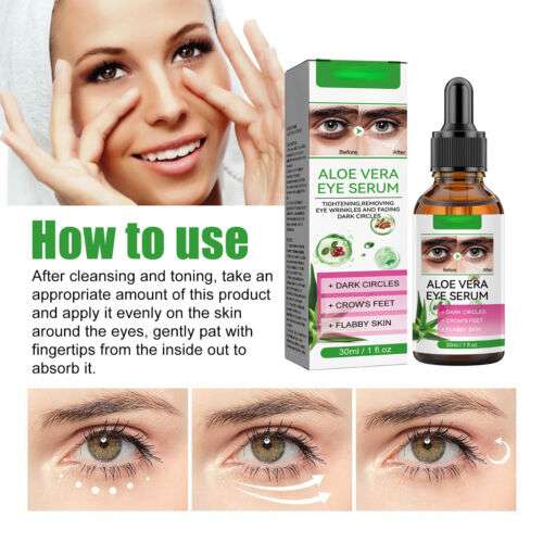 Aloe Vera Eye Serum (30ml) – ✨ Fades Eye Dark Circles, Wrinkles & Fine Line