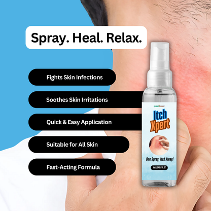 ItchXpert Anti Fungal Spray (30ml)