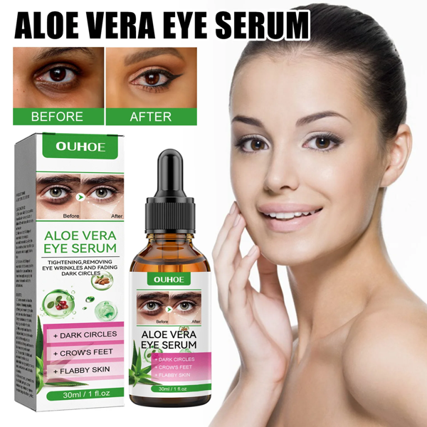 Aloe Vera Eye Serum (30ml) – ✨ Fades Eye Dark Circles, Wrinkles & Fine Line