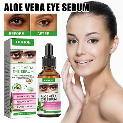 Aloe Vera Eye Serum (30ml) – ✨ Fades Eye Dark Circles, Wrinkles & Fine Line