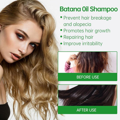 Batana Oil Shampoo for Hair Growth with Rosemary Extract🌱✨(Buy 1 Get 1 Free)