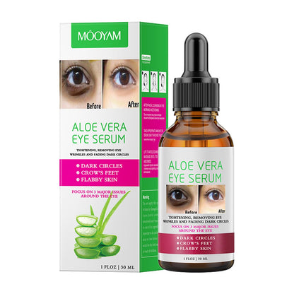Aloe Vera Eye Serum (30ml) – ✨ Fades Eye Dark Circles, Wrinkles & Fine Line