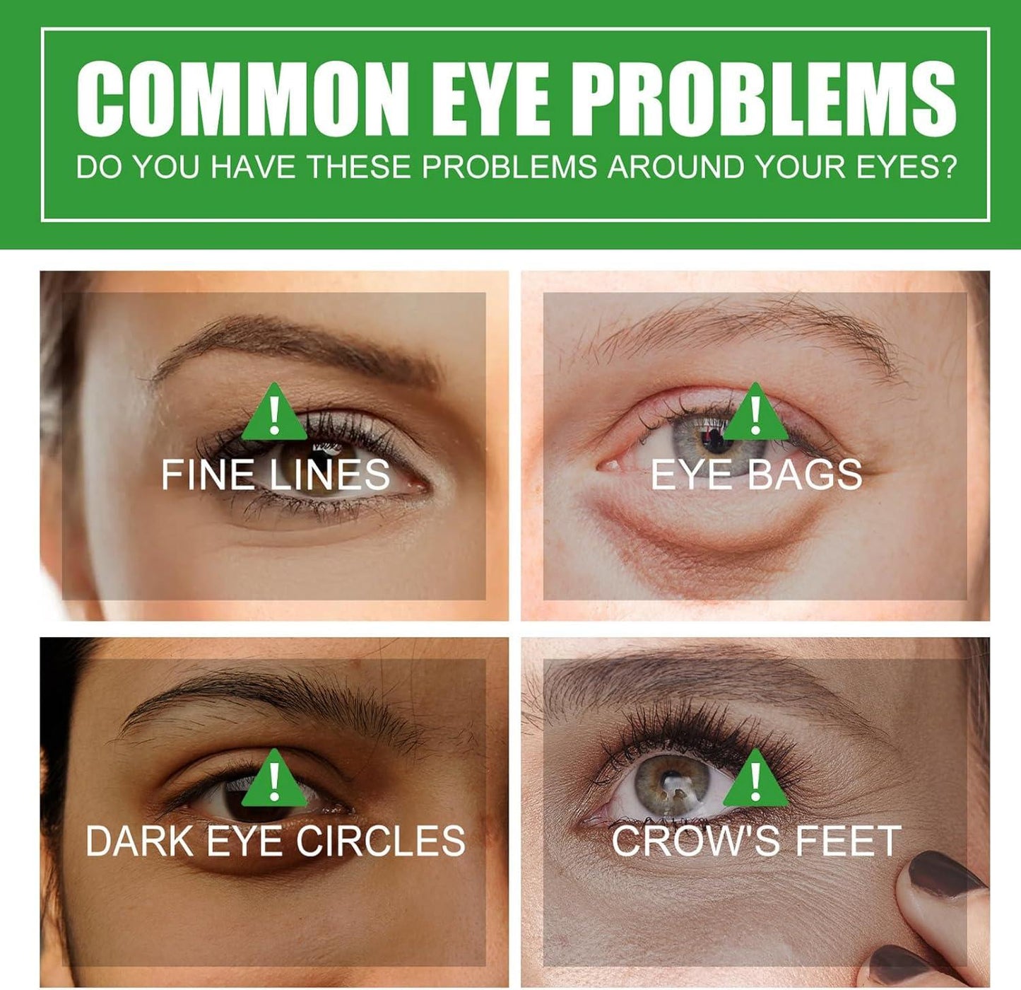 Aloe Vera Eye Serum (30ml) – ✨ Fades Eye Dark Circles, Wrinkles & Fine Line