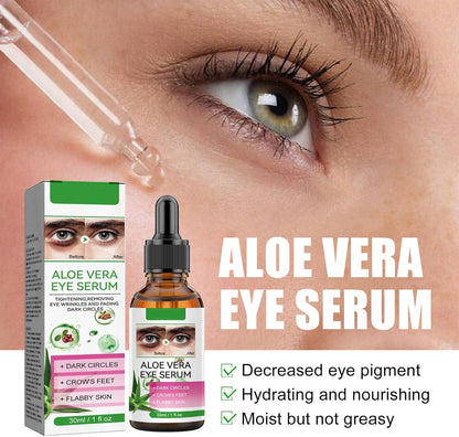 Aloe Vera Eye Serum (30ml) – ✨ Fades Eye Dark Circles, Wrinkles & Fine Line