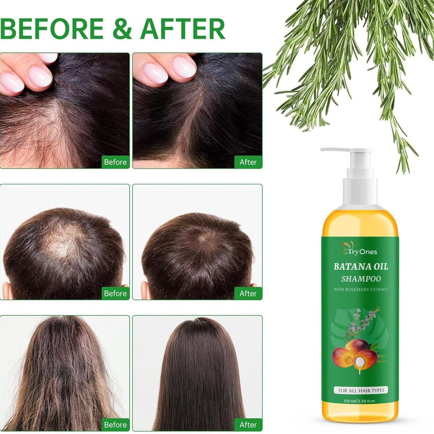 Batana Oil Shampoo for Hair Growth with Rosemary Extract🌱✨(Buy 1 Get 1 Free)