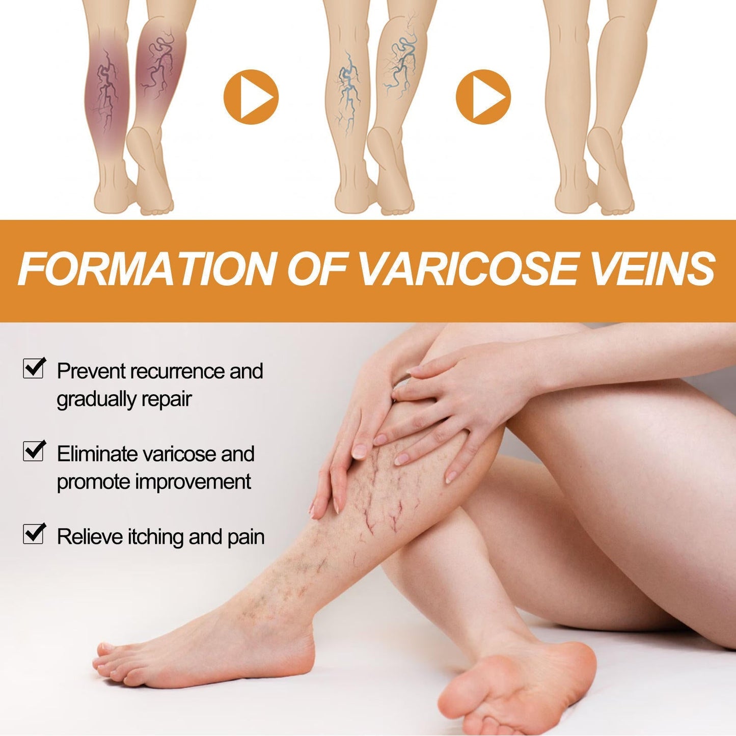 VeinVeda™ Varicose Vein Relief Spray ( BUY 1 GET 2 FREE )