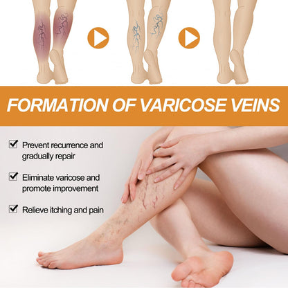 VeinVeda™ Varicose Vein Relief Spray ( BUY 1 GET 2 FREE )