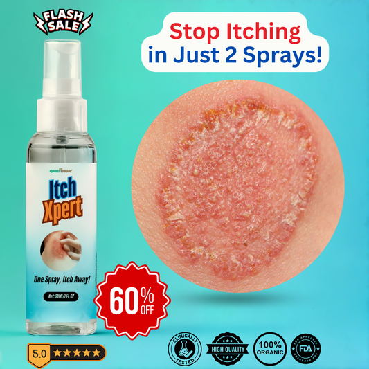 ItchXpert Anti Fungal Spray (30ml)