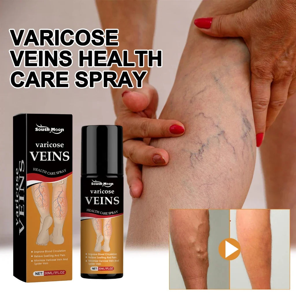 VeinVeda™ Varicose Vein Relief Spray ( BUY 1 GET 2 FREE )