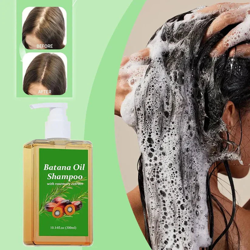Batana Oil Shampoo for Hair Growth with Rosemary Extract🌱✨(Buy 1 Get 1 Free)