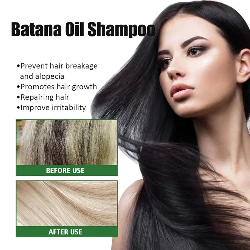 Batana Oil Shampoo for Hair Growth with Rosemary Extract🌱✨(Buy 1 Get 1 Free)