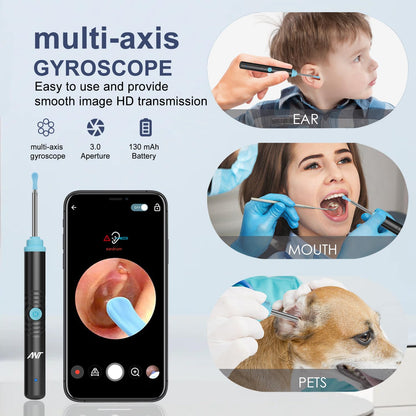 HD Wireless Ear Wax Cleaner Kit with Camera
