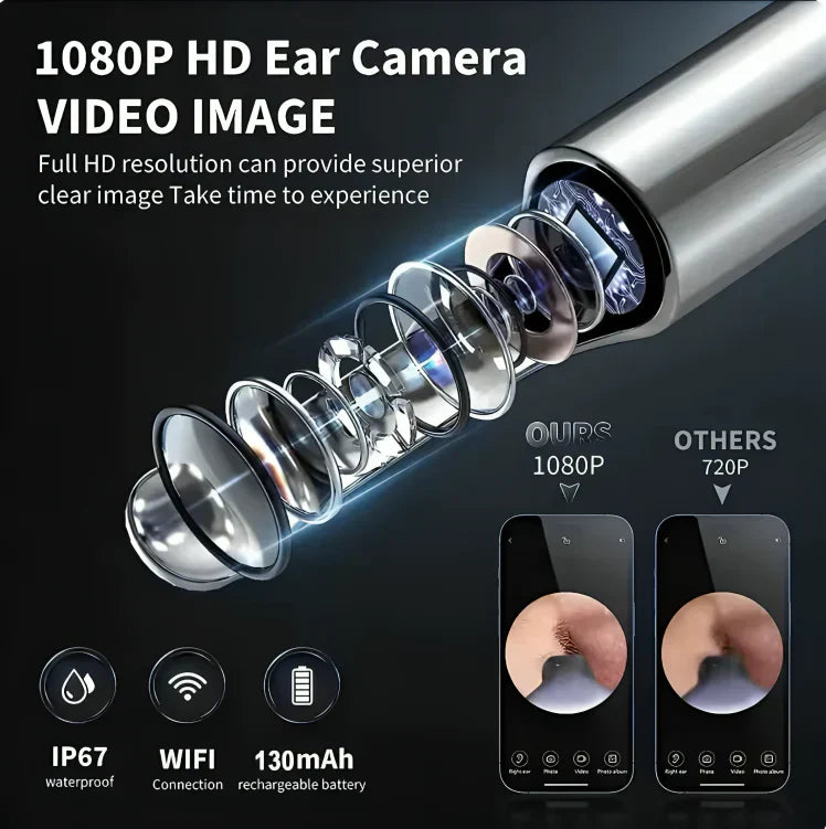 HD Wireless Ear Wax Cleaner Kit with Camera