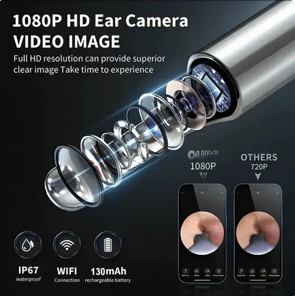 HD Wireless Ear Wax Cleaner Kit with Camera