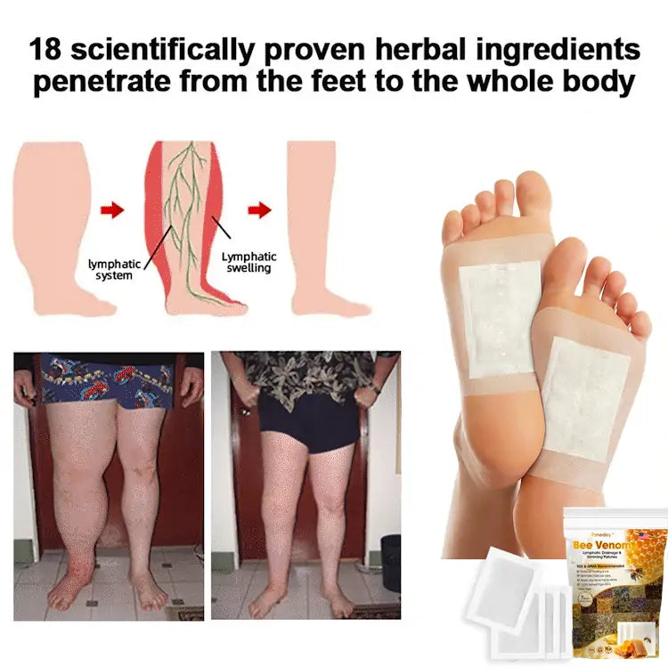 Bee Venom Lymphatic Drainage & Slimming Foot Patches 🌿👣 – Buy 1 Get 1 Free!