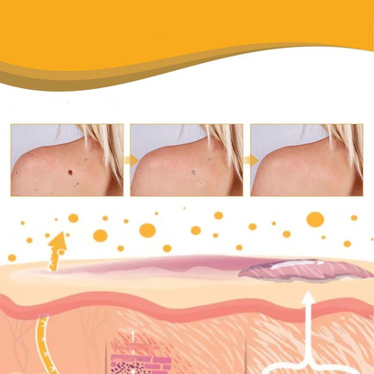 Bee Venom Skin Tag & Wart Remover Spray