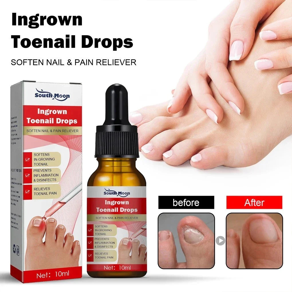 SouthMoon Ingrown Toenail Drops Nail Fungal Repair ( BUY 1 GET 2 FREE )