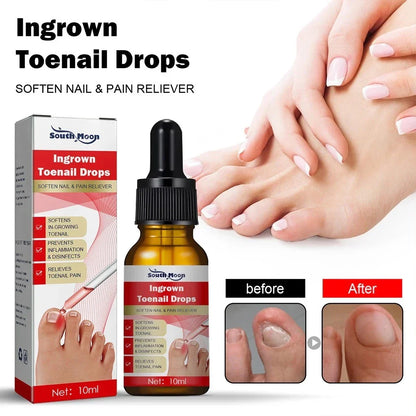 SouthMoon Ingrown Toenail Drops Nail Fungal Repair ( BUY 1 GET 2 FREE )